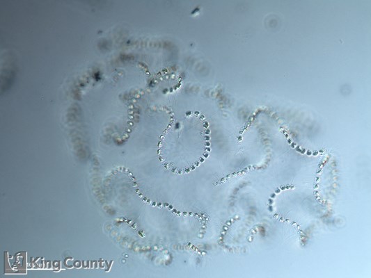 Photo of Chaetoceros socialis